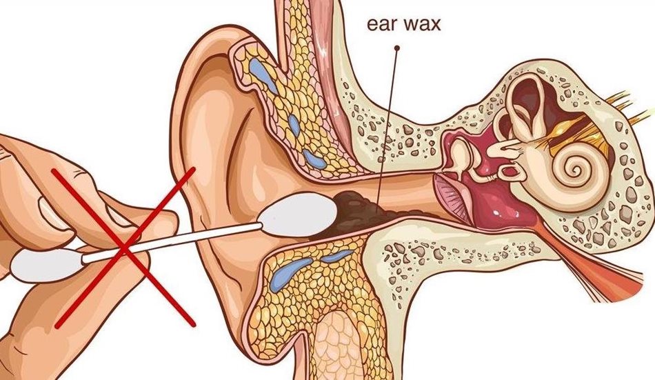 Comment nettoyer ses oreilles correctement ? - Conseils santé